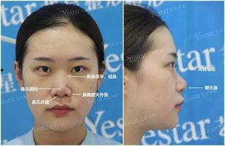 全祼美女无码大图