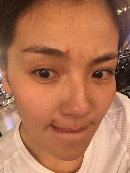 韩国明星不起痘,不起痘的秘密解析